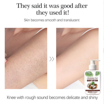 Coconut Body Lotion Hydrating